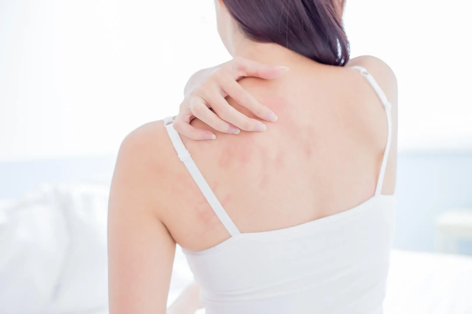skin itching allergy