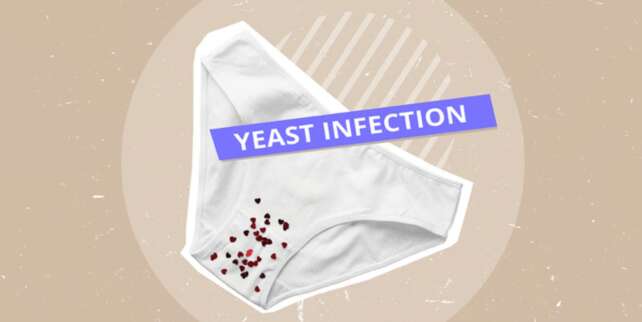 can a yeast infection mess with your period