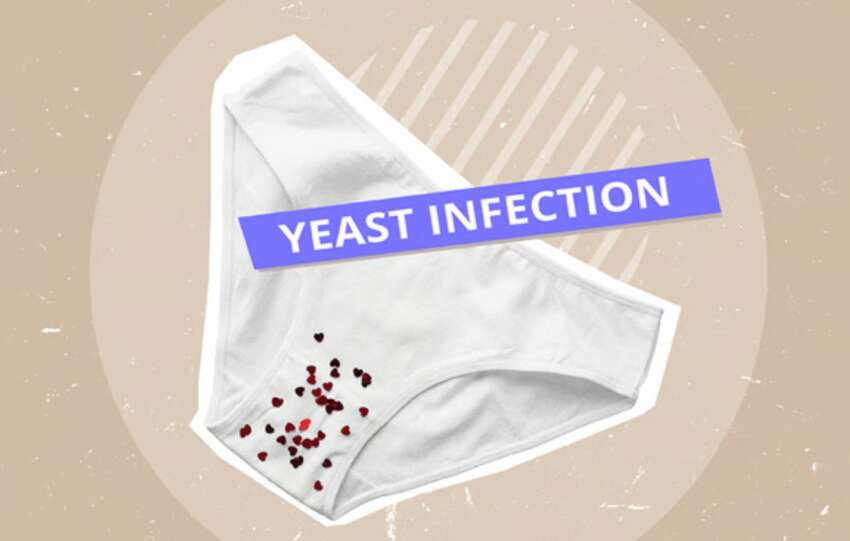 can a yeast infection mess with your period