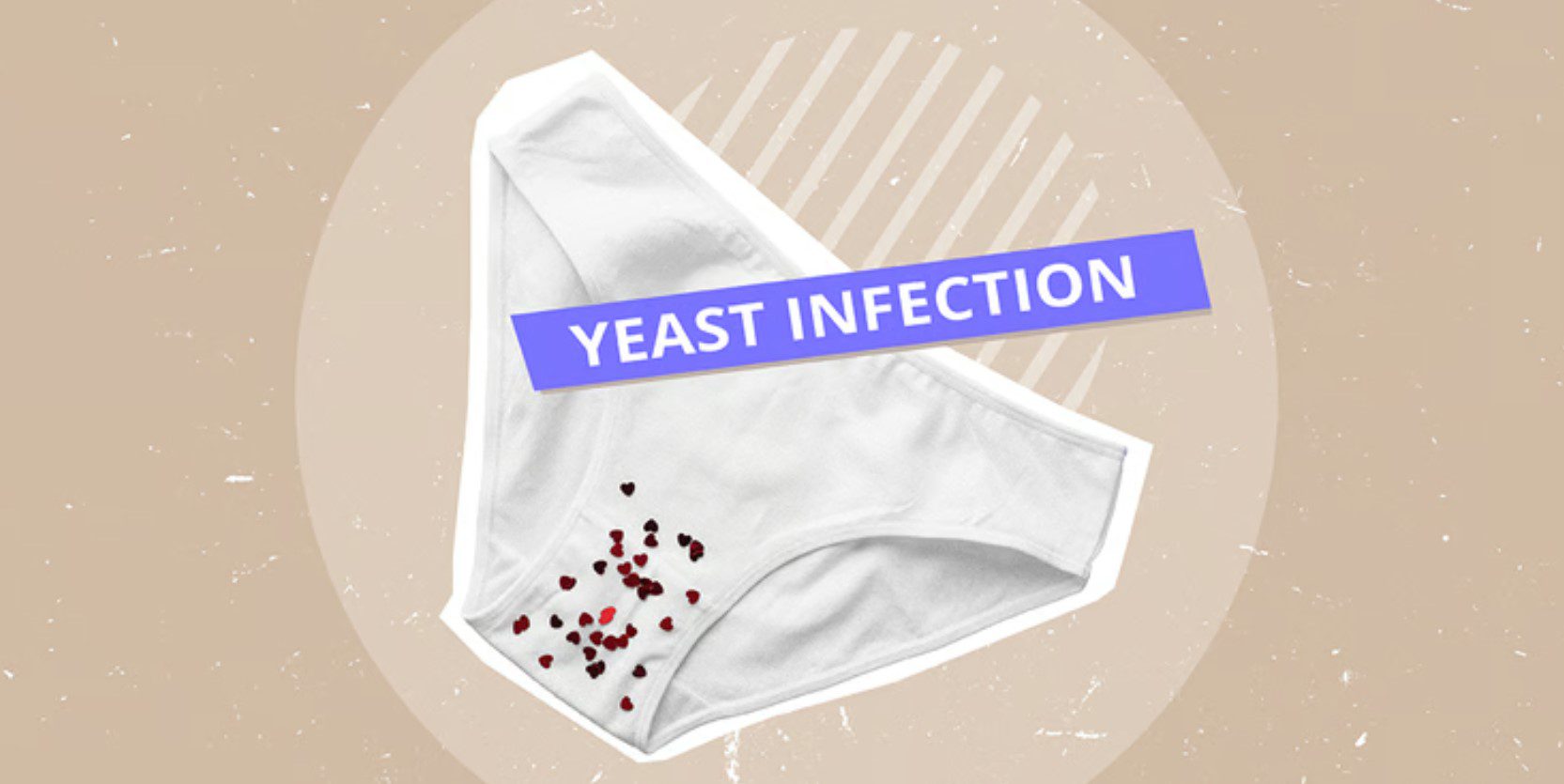can a yeast infection mess with your period