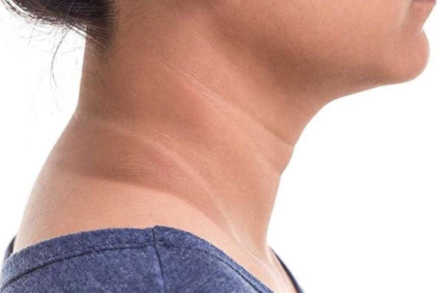 how to remove dirt from neck